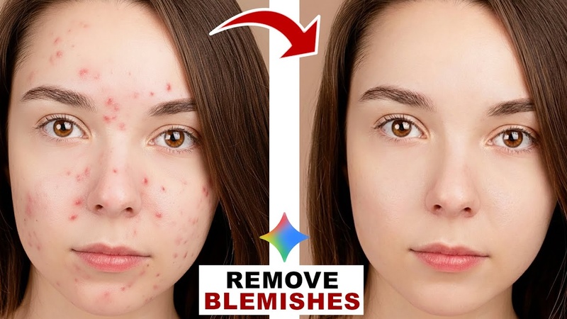 google gemini photo editing prompts for blemish removal